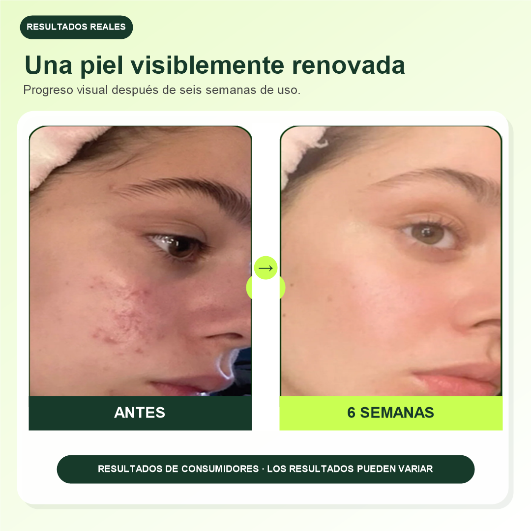 Toner Pads con Esencia Multiactiva + Lip Mask GRATIS
