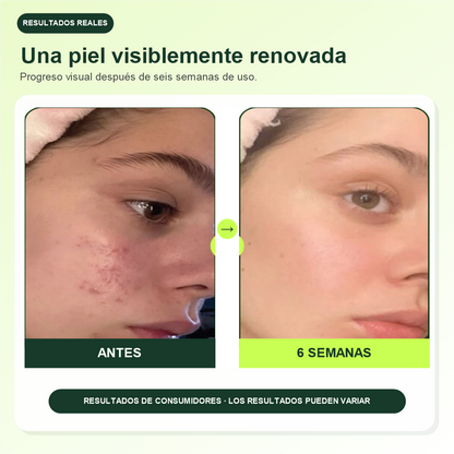 Toner Pads con Esencia Multiactiva + Lip Mask GRATIS