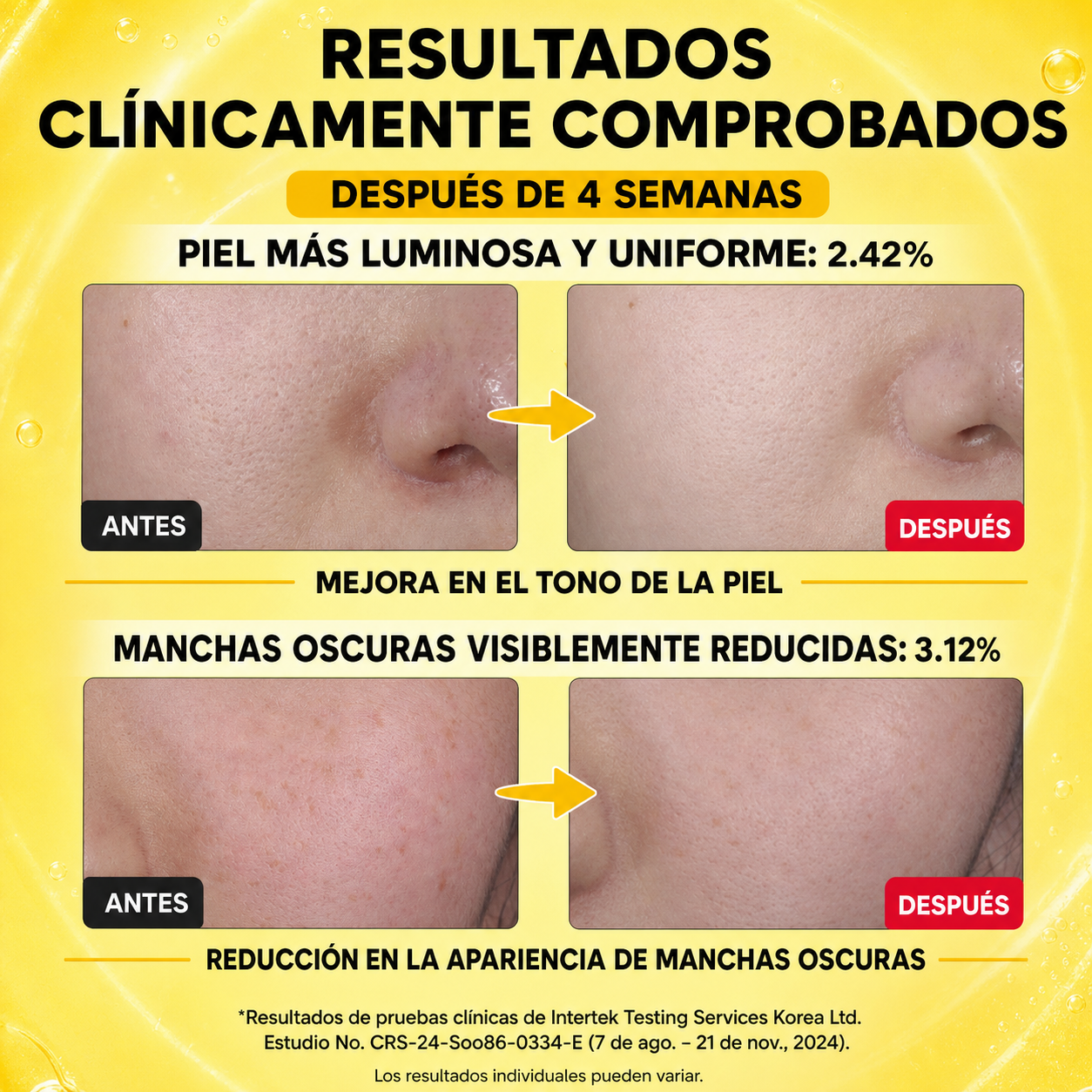 Suero iluminador de vitamina C para brillo facial con ácido hialurónico | Cuidado de manchas oscuras y tonos desiguales