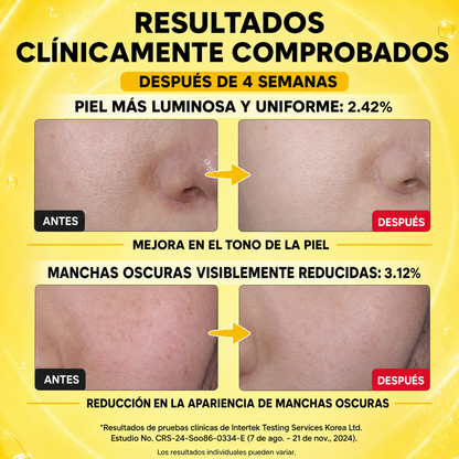 Suero iluminador de vitamina C para brillo facial con ácido hialurónico | Cuidado de manchas oscuras y tonos desiguales