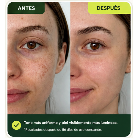 Antes y después de Mariela