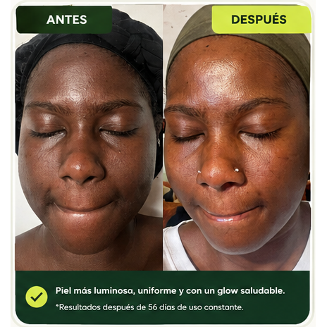 Antes y después de Rosa