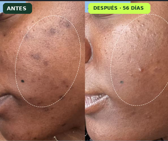 Antes y después del serum iluminador