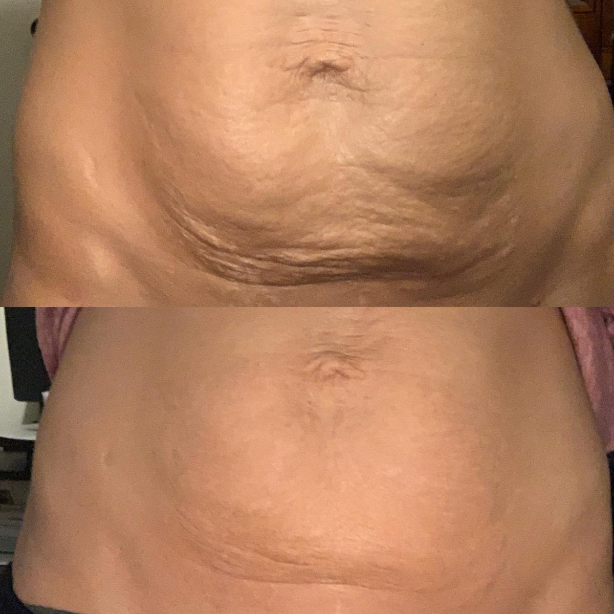 Antes y después