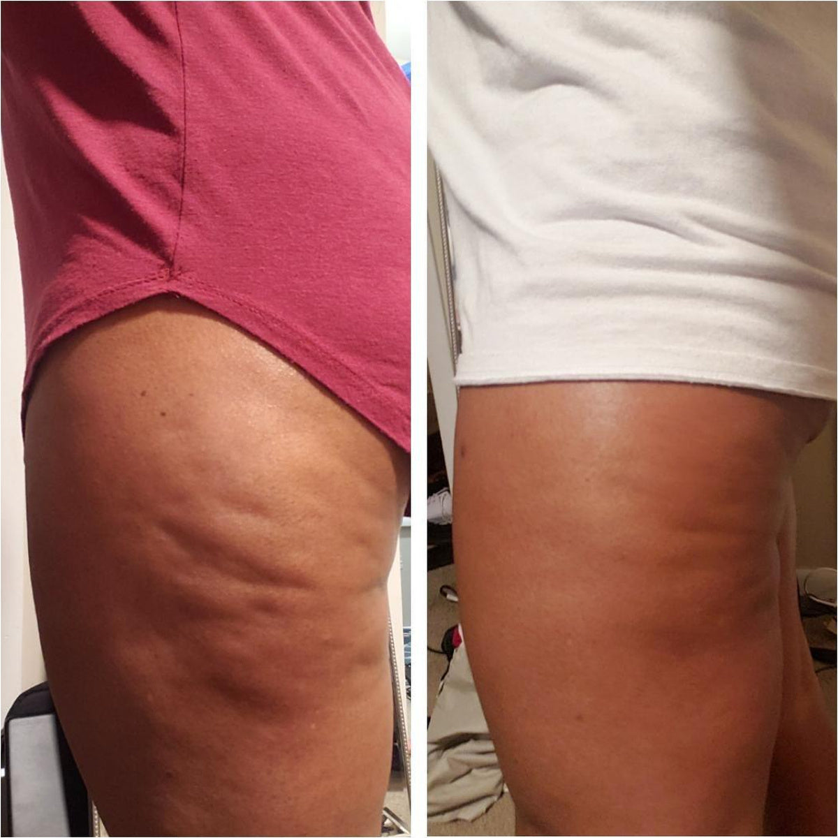 Antes y después